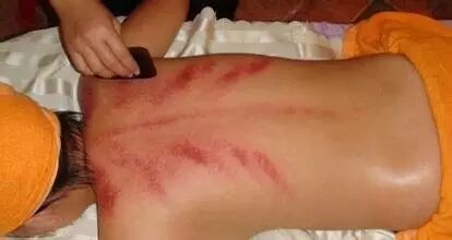 Gua Sha Massage Tool