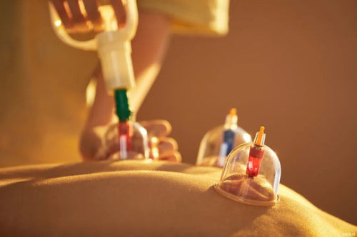 Cupping Therapy Set