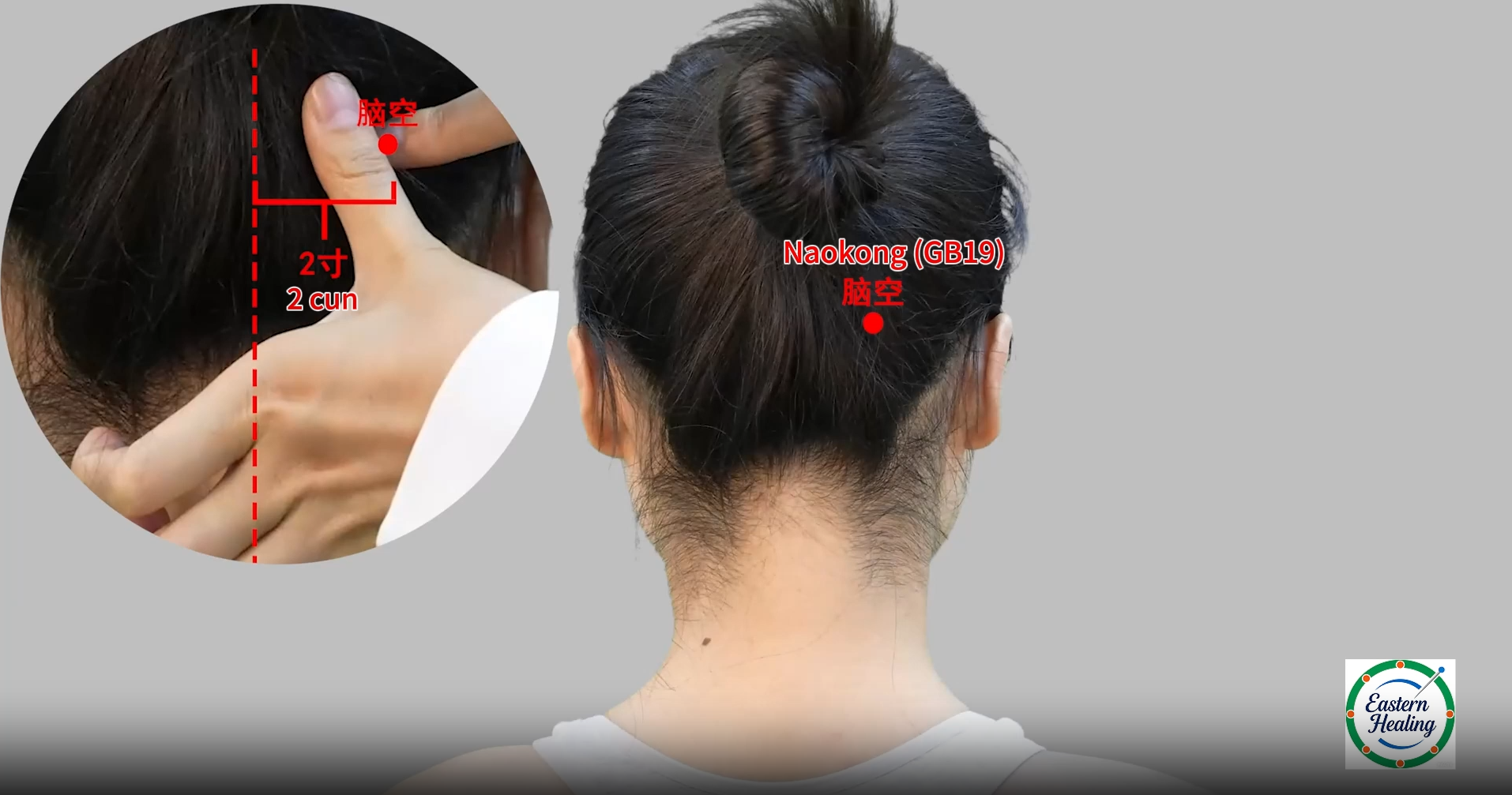 Gallbladder Meridian (GB)