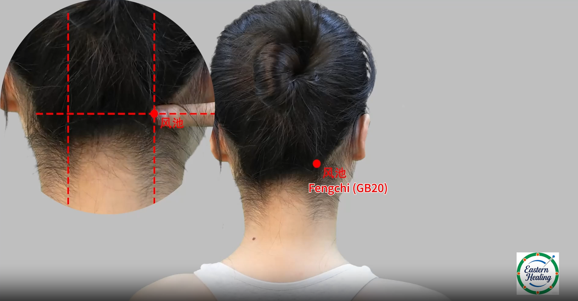 Gallbladder Meridian (GB)